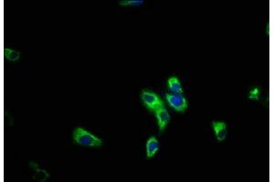 Immunofluorescence staining of HepG2 cells with ABIN7163295 at 1:200, counter-stained with DAPI. (PIK3R5 anticorps  (Regulatory Subunit 5))