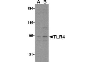 Image no. 1 for anti-Toll-Like Receptor 4 (TLR4) (N-Term) antibody (ABIN951277) (TLR4 anticorps  (N-Term))