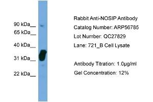WB Suggested Anti-NOSIP  Antibody Titration: 0. (NOSIP anticorps  (Middle Region))