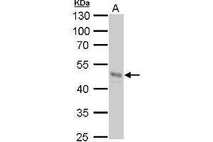 WB Image GNAS antibody [C2C3-2], C-term detects GNAS protein by Western blot analysis.