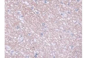 DAB staining on IHC-P; Samples: Human Cerebrum Tissue
