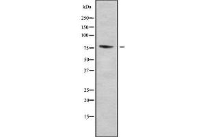 Western blot analysis of ZNF7 using COLO205 whole cell lysates (ZNF7 anticorps  (Internal Region))