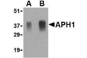 Western blot analysis of APH1 in human brain tissue lysate with AP30067PU-N APH1 antibody at (A) 0.