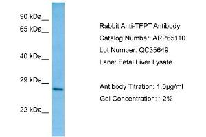 Western Blotting (WB) image for anti-TCF3 (E2A) Fusion Partner (In Childhood Leukemia) (TFPT) (C-Term) antibody (ABIN2790046) (TFPT anticorps  (C-Term))