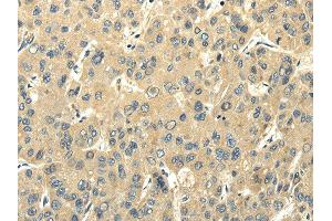 Immunohistochemistry (IHC) image for anti-Peripheral Myelin Protein 2 (PMP2) antibody (ABIN5961300) (PMP2 anticorps)