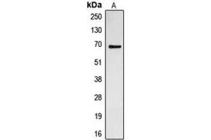 Western blot analysis of CDC23 expression in Jurkat (A) whole cell lysates. (CDC23 anticorps  (Center))