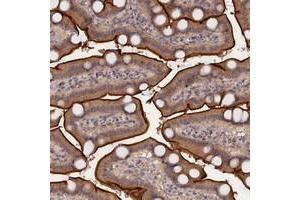 Immunohistochemical staining of human duodenum with TMC5 polyclonal antibody  shows cytoplasmic and membranous positivity in glandular cells at 1:200-1:500 dilution. (Tmc5 anticorps)