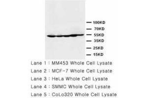 Image no. 1 for anti-Histone Deacetylase 2 (HDAC2) (AA 464-478) antibody (ABIN1493469) (HDAC2 anticorps  (AA 464-478))
