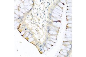 Immunohistochemistry of paraffin-embedded human colon using CPA1 antibody at dilution of 1:100 (40x lens). (CPA1 anticorps)