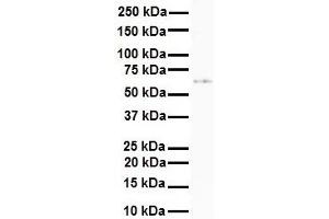 WB Suggested Anti-SLC7A1 antibody Titration: 1 ug/mL Sample Type: Human 721_B