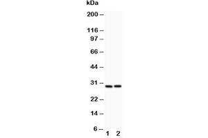 Western blot testing of Bcl2A1 antibody and (1) HeLa, (2) Jurkat lysate (BCL2A1 anticorps  (N-Term))