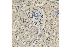 Immunohistochemistry of paraffin-embedded mouse kidney using PSMB9 antibody at dilution of 1:200 (x400 lens).