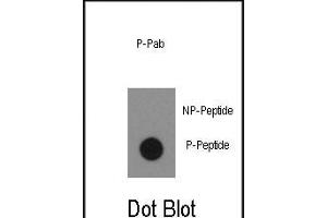 Dot blot analysis of anti-Phospho-ABL1- Antibody (ABIN389501 and ABIN2839559) on nitrocellulose membrane. (ABL1 anticorps  (pTyr134))