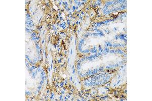 Immunohistochemistry of paraffin-embedded rat lung using Collagen VI/COL6 Rabbit mAb (ABIN7266462) at dilution of 1:100 (40x lens).