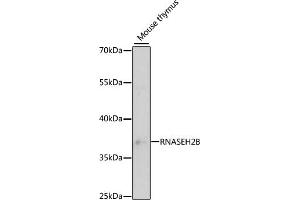 Western blot analysis of extracts of mouse thymus, using RNB antibody (ABIN6133304, ABIN6146990, ABIN6146991 and ABIN6220814) at 1:3000 dilution. (RNASEH2B anticorps  (AA 1-290))