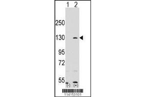 Western blot analysis of PARP1 using rabbit polyclonal PARP1 Antibody using 293 cell lysates (2 ug/lane) either nontransfected (Lane 1) or transiently transfected with the PARP1 gene (Lane 2).