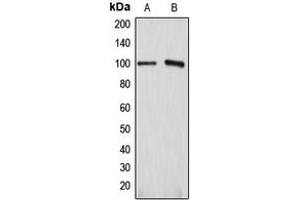 Western blot analysis of ATP1A1 expression in HEK293T (A), HeLa (B) whole cell lysates. (ATP1A1 anticorps  (Center))