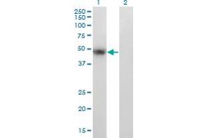 Western Blot analysis of PAX8 expression in transfected 293T cell line by PAX8 monoclonal antibody (M23), clone 2F1. (PAX8 anticorps  (AA 141-250))