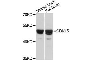 Western blot analysis of extracts of various cell lines, using CDK15 antibody (ABIN6292714) at 1:3000 dilution. (Cyclin-Dependent Kinase 15 (ALS2CR7) anticorps)