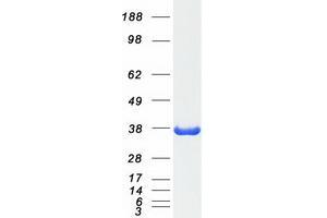 Validation with Western Blot