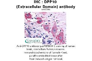 Image no. 1 for anti-Dipeptidylpeptidase 10 (DPP10) (Extracellular Domain) antibody (ABIN1733742) (DPP10 anticorps  (Extracellular Domain))