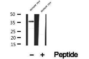 Western blot analysis of extracts of mouse eye tissue, using PRPH2 antibody. (PRPH2 anticorps  (Internal Region))