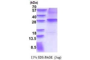 SDS-PAGE (SDS) image for MDS1 and EVI1 Complex Locus (MECOM) (AA 1-169) protein (His tag) (ABIN6387329)
