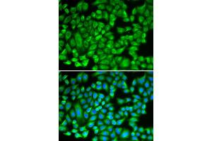 Immunofluorescence analysis of A549 cells using KAT5 antibody (ABIN6292501). (KAT5 anticorps)