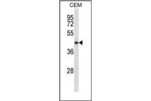Western blot analysis of NDRG2 Antibody (N-term) in CEM cell line lysates (35ug/lane). (NDRG2 anticorps  (N-Term))