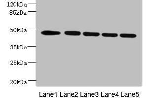 Western blot All lanes: DCXR antibody at 4. (VRK1 anticorps  (AA 257-396))