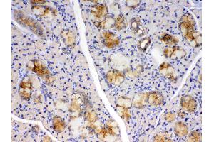 IHC analysis of Cyclophilin B using anti-Cyclophilin B antibody .