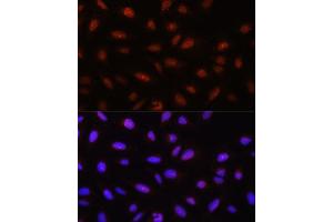 Immunofluorescence analysis of U-2 OS cells using // antibody (ABIN7265520) at dilution of 1:100. (AKT 1/2/3 anticorps)