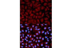 Immunofluorescence analysis of U2OS cell using SERPINC1 antibody. (SERPINC1 anticorps  (AA 33-185))