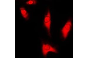 Immunofluorescent analysis of DJ-1 staining in HeLa cells. (PARK7/DJ1 anticorps  (Center))