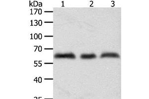 Western Blot analysis of A375, Hela and Jurkat cell using TYR Polyclonal Antibody at dilution of 1:600 (TYR anticorps)