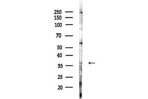 anti-Neuroblastoma Breakpoint Family, Member 5 (NBPF5) antibody