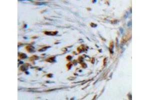 Used in DAB staining on fromalin fixed paraffin-embedded lung tissue (KDM4A anticorps  (AA 141-310))