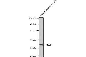 Western blot analysis of extracts of mouse skeletal muscle, using FRZB antibody (ABIN6131654, ABIN6140777, ABIN6140778 and ABIN6222275) at 1:1000 dilution. (FRZB anticorps  (AA 166-325))