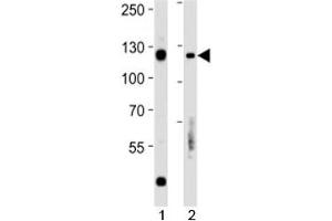 Rb antibody western blot analysis in 1) Daudi and 2) Raji lysate. (Retinoblastoma Protein (Rb) anticorps  (AA 586-615))