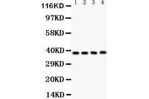 Anti- IKB beta Picoband antibody, Western blotting All lanes: Anti IKB beta  at 0. (NFKBIB anticorps  (AA 56-237))