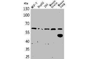 Western Blot analysis of MCF7 HepG2 293 mouse brain mouse lung cells using ZKSCAN4 Polyclonal Antibody (ZKSCAN4 anticorps  (Internal Region))