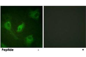 Immunofluorescence analysis of HeLa cells, using NFKBIE polyclonal antibody . (NFKBIE anticorps)