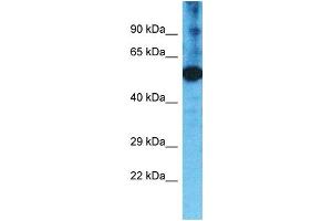 Western Blotting (WB) image for anti-Transmembrane Protease, Serine 11F (TMPRSS11F) (C-Term) antibody (ABIN2791959) (TMPRSS11F anticorps  (C-Term))