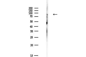 Western blot analysis of lysates from HepG2 cells(LPS,4h treatment), using GluR2 Antibody at 1/1000 dilution.