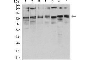 Western blot analysis using GFPT1 mouse mAb against HepG2 (1), HEK293 (2), BEL-7402 (3), SMMC-7721 (4), SK-MES-1 (5), C6 (6), and COS7 (7) cell lysate.