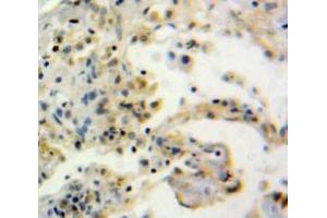 Used in DAB staining on fromalin fixed paraffin-embedded Lung tissue (Thimet Oligopeptidase 1 anticorps  (AA 451-597))