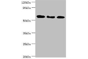 Western blot All lanes: Interferon-induced guanylate-binding protein 1 antibody at 4 μg/mL Lane 1: MM231 whole cell lysate Lane 2: Hela whole cell lysate Lane 3: MGF-7 whole cell lysate Secondary Goat polyclonal to rabbit IgG at 1/10000 dilution Predicted band size: 68 kDa Observed band size: 68 kDa (GBP1 anticorps  (AA 383-592))