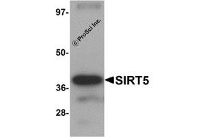 Western Blotting (WB) image for anti-Sirtuin 5 (SIRT5) (C-Term) antibody (ABIN1030665) (SIRT5 anticorps  (C-Term))