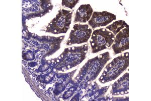 IHC analysis of GDA using anti-GDA antibody .