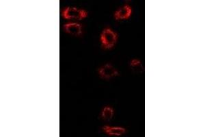 Immunofluorescent analysis of Syntenin staining in SW480 cells.